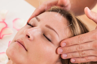 10 Acupuncture points for Moms: Ancient Solutions for Postpartum Hair Loss